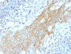 CD59 Antibody (MACIF/1193), Novus Biologicals 0.2mg; Unlabeled:Antibodies,